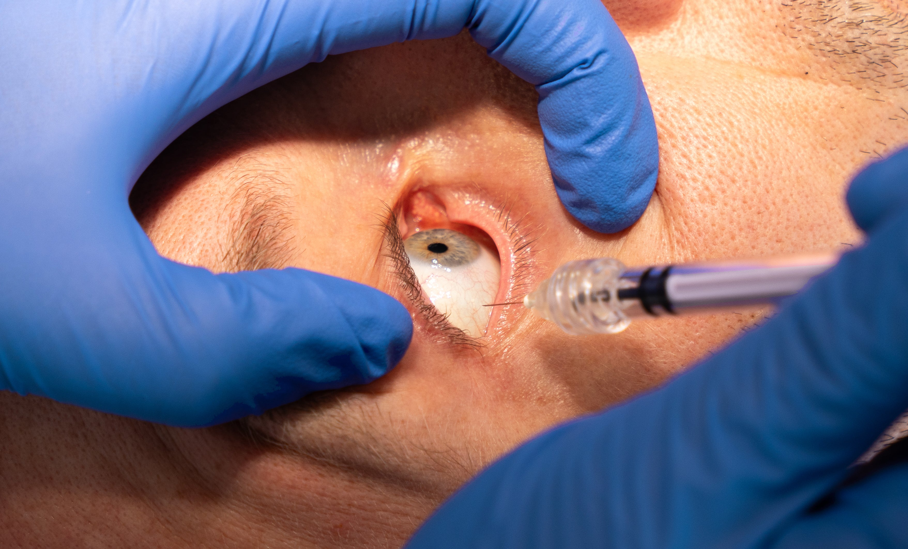 Ophthalmic